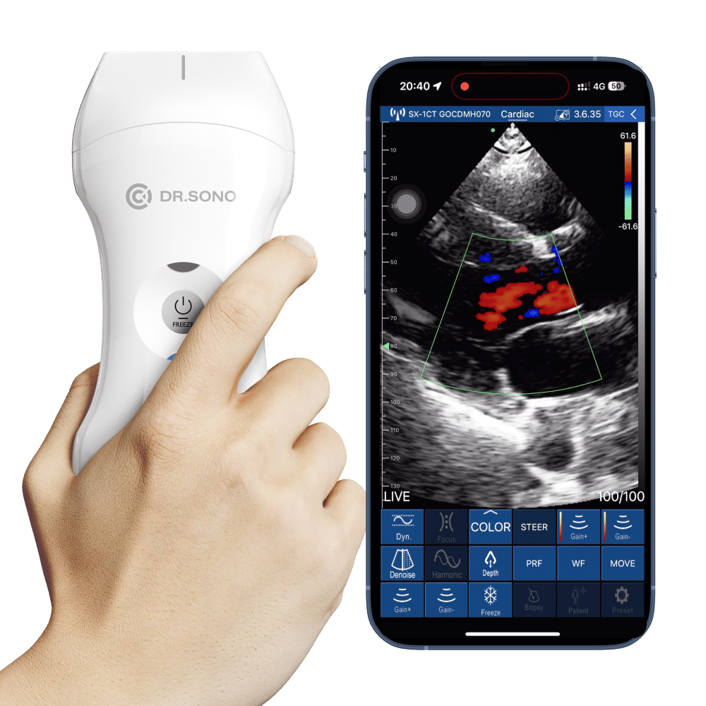 Portable Ultrasound machine
