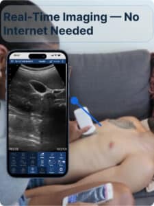 drsono Best Portable Ultrasound machine