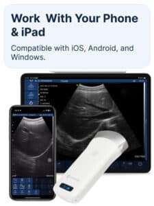 drsono Best Portable Ultrasound scanner