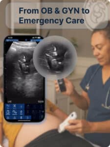 drsono Best handheld Ultrasound scanner