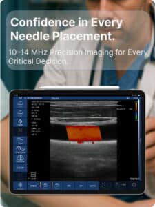 drsono Portabl Ultrasonidos PICC line