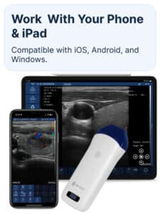 drsono Ecógrafo portátil iPhone Ultrasonido