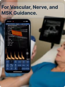 drsono Ecógrafo portátil para acceso vascular