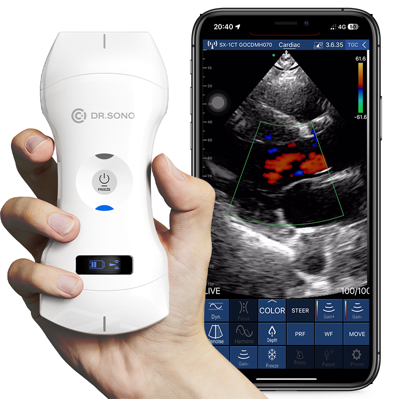 ecógrafo portátil inalámbrico
