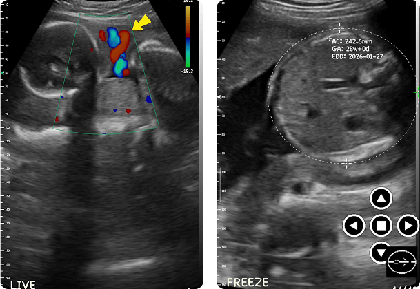 DRSONO Ecógrafo portátil