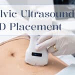 DRSONO Pelvic Ultrasound IUD Placement