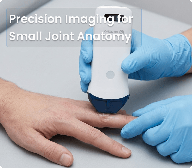 Portable Ultrasound Machine for Small joint (1)