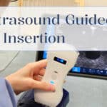 Portable Ultrasound Scanner Guided IV Insertion