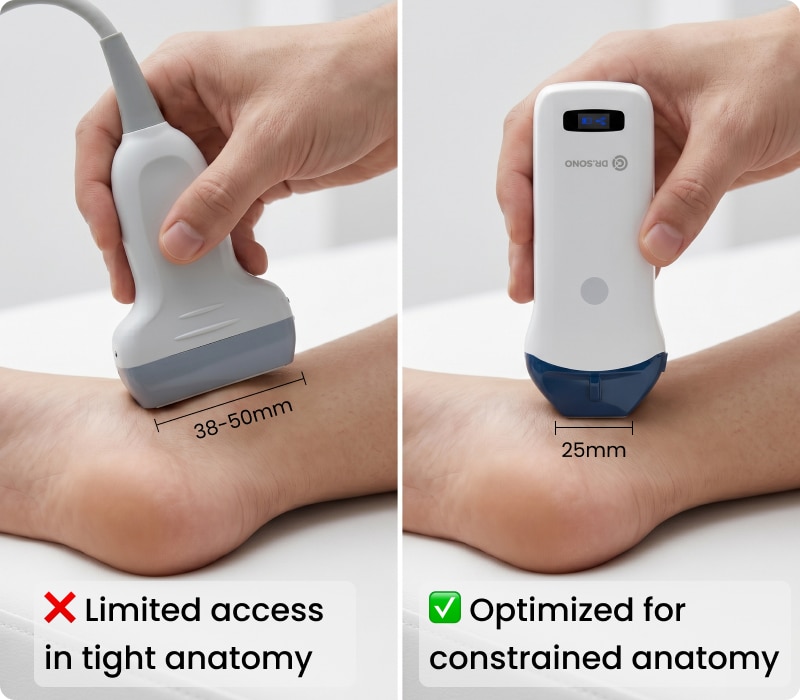 Portable Ultrasound Scanner for MSK